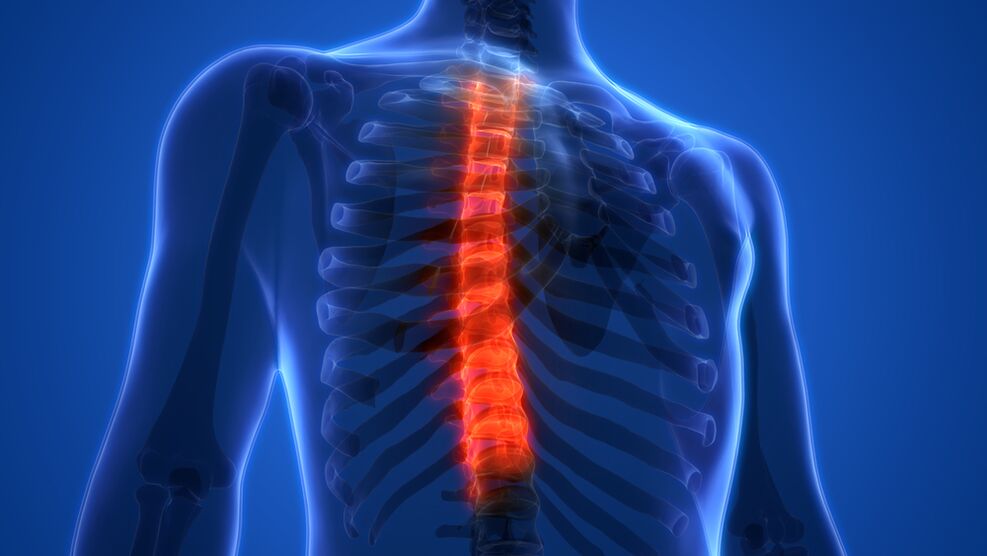 Osteohondroza torakalne hrbtenice