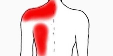 bolečina pod levo lopatico od zadaj