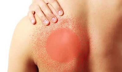 bolečina pod levo lopatico