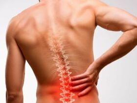 bolečine v spodnjem delu hrbta zaradi osteohondroze